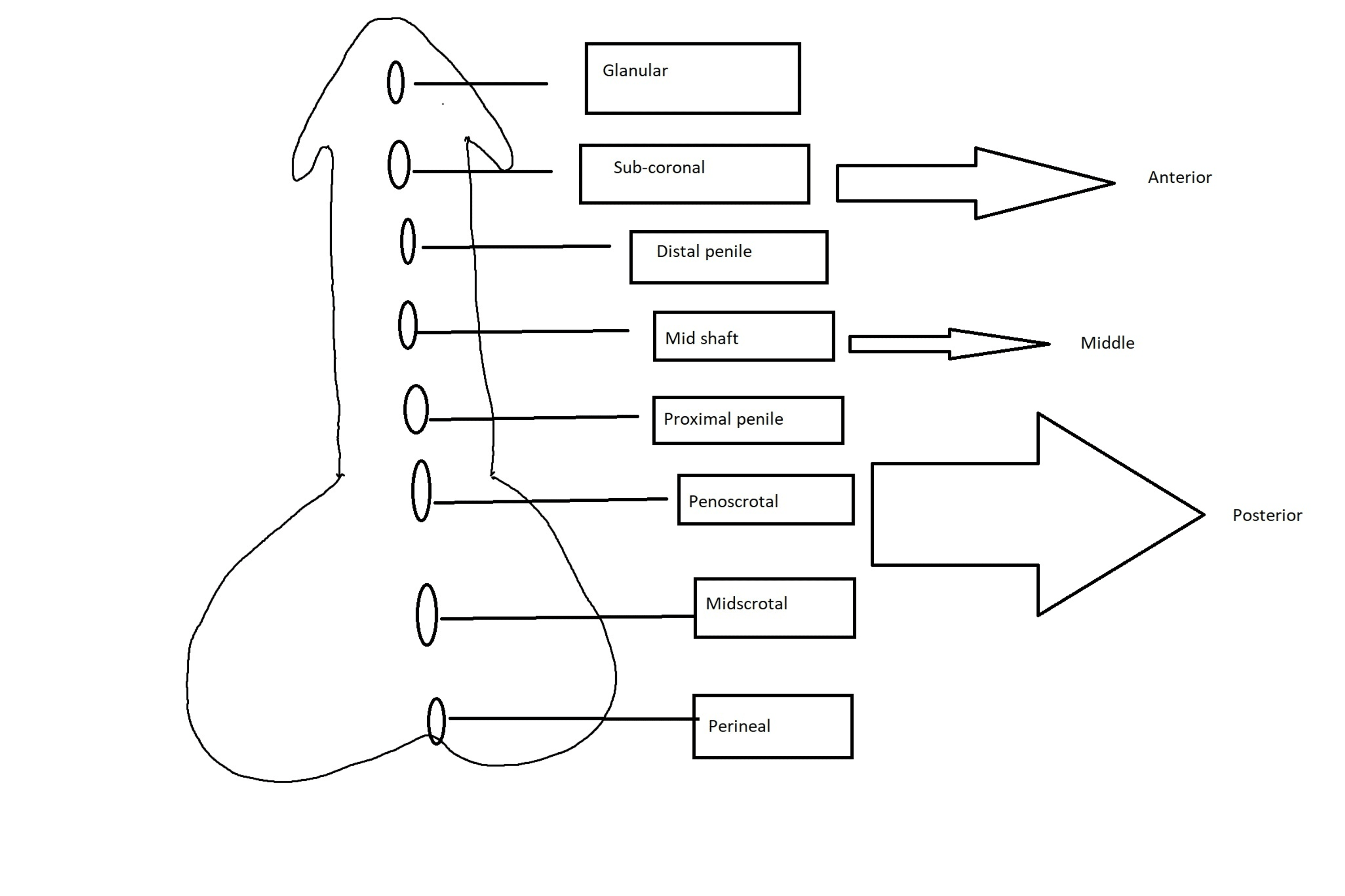 Cureus Hypospadias A Comprehensive Review Including Its Embryology