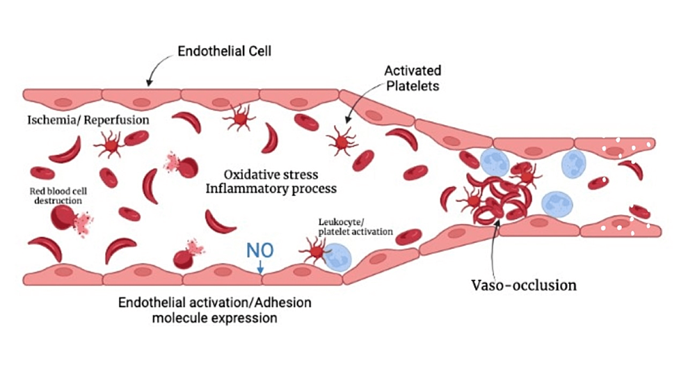 Cureus Emerging Therapies for the Management of Pain and Vaso