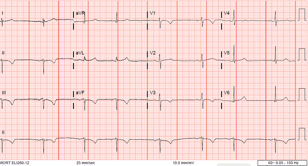 Postpartum Maternal Hypothermia in an Adolescent Patient Following ...