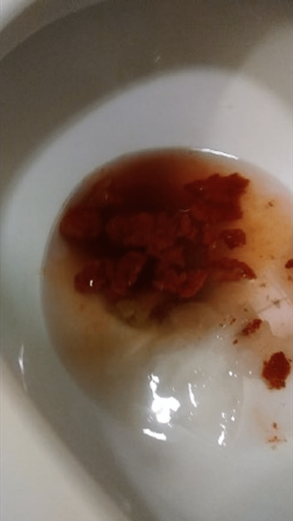 feces with blood