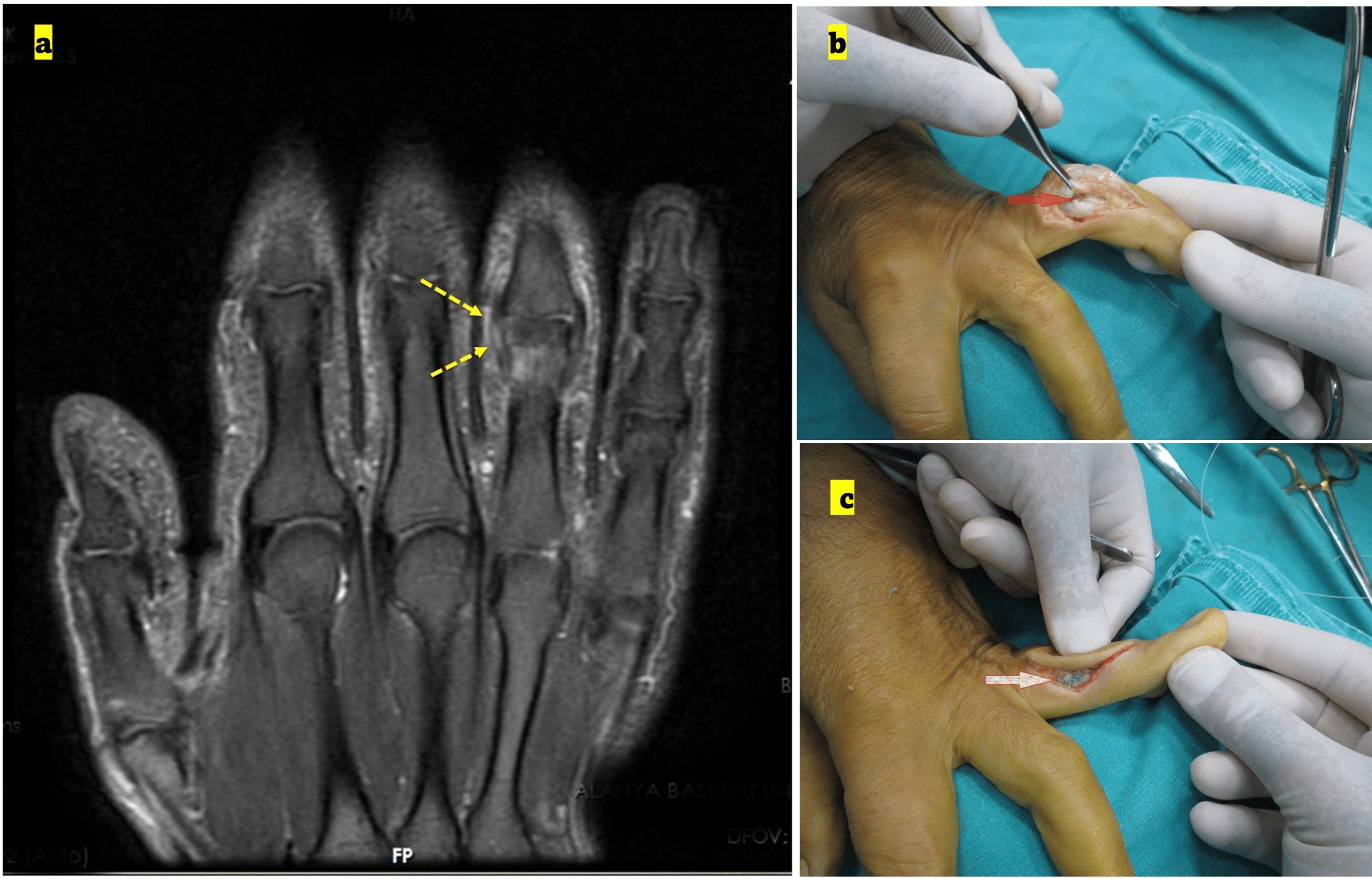 The Accuracy and CostEffectiveness of MRI Assessment of Collateral
