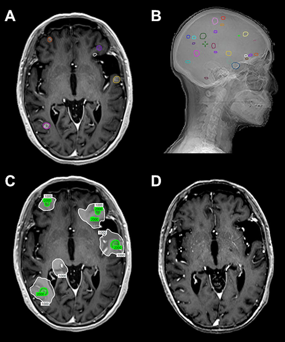 https://assets.cureus.com/uploads/figure/file/432135/article_river_2a5ae0c01a5311edba85d1861646fc60-Figure-1.png