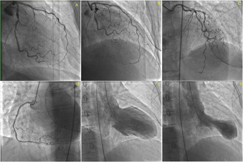 The-patient’s-cardiac-catheterization-images