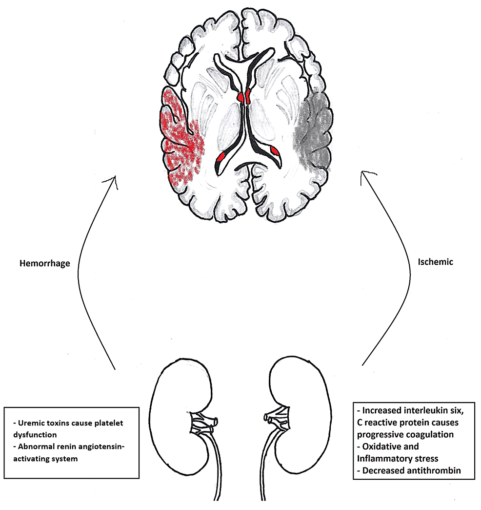 Cureus Role of Anticoagulants for Stroke Prevention in LowRisk