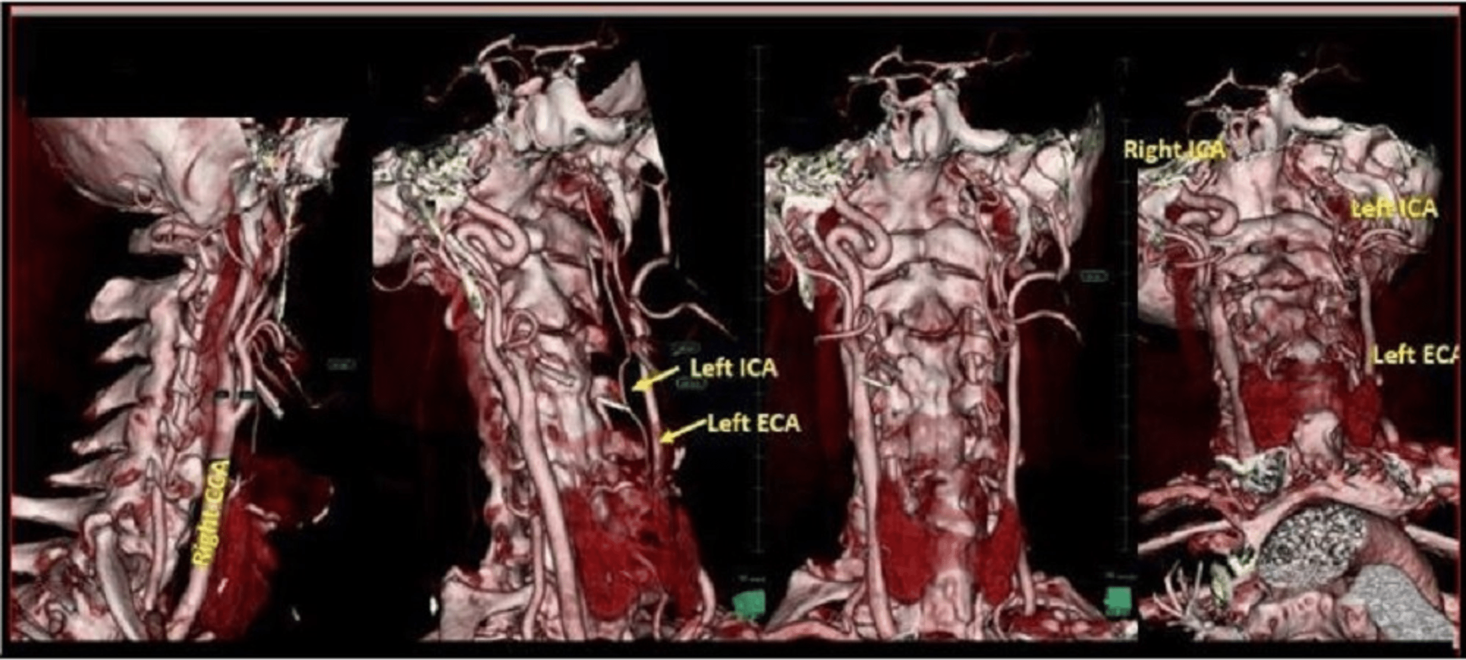 arteries of the aortic arch