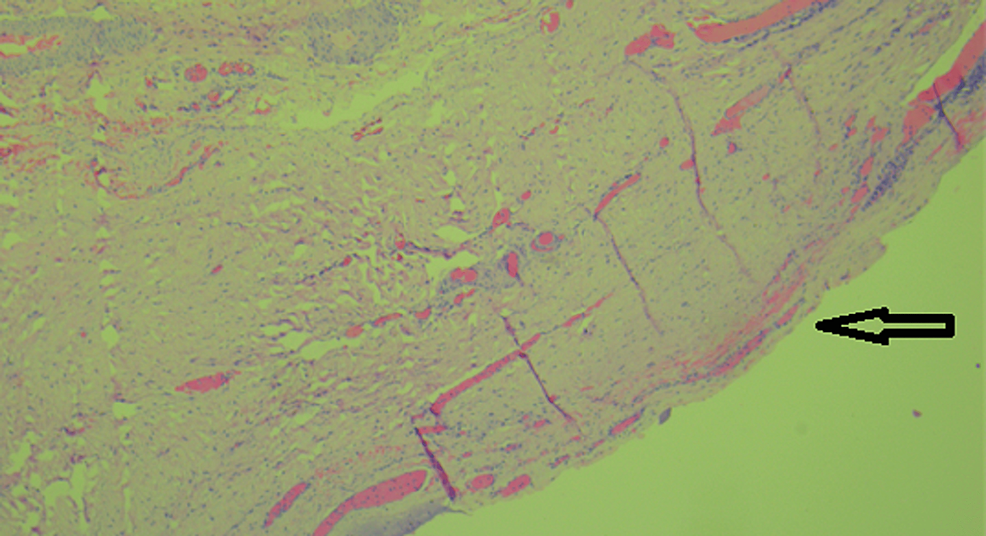 Hematoxylin-and-eosin-staining-with-fibroconnective-vascular-tissues-(40×)
