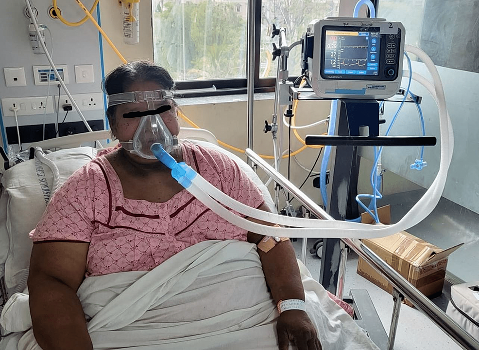 Clinical-photograph-of-the-patient-in-the-ICU-on-non-invasive-positive-pressure-ventilation-(NIPPV)-support