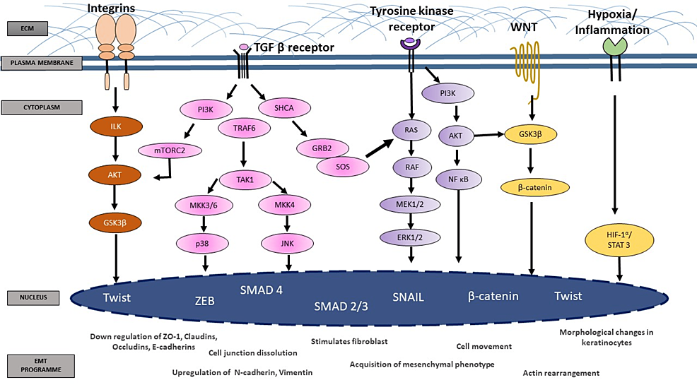 Is Epithelial-mesenchymal Transition A New Roadway In The Pathogenesis 