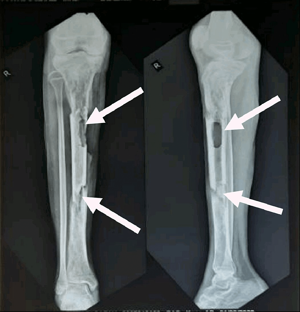 A biomimetic engineered bone platform for advanced testing of prosthetic  implants | Scientific Reports