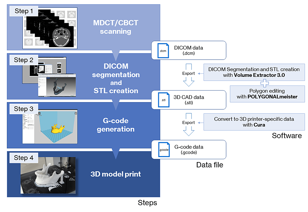 The-fabrication-process-workflow-for-the-3D-model-with-an-FDM-3D-printer.
