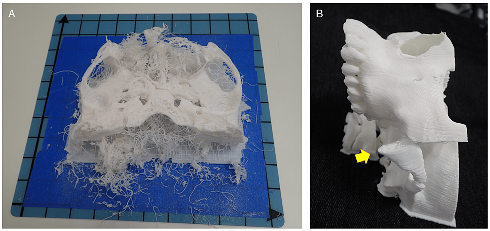 Examples-of-3D-printing-failures.