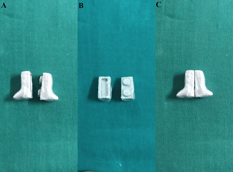 Cureus Custom Sectional Impression Tray With Sectional Handle for Microstomia Patients