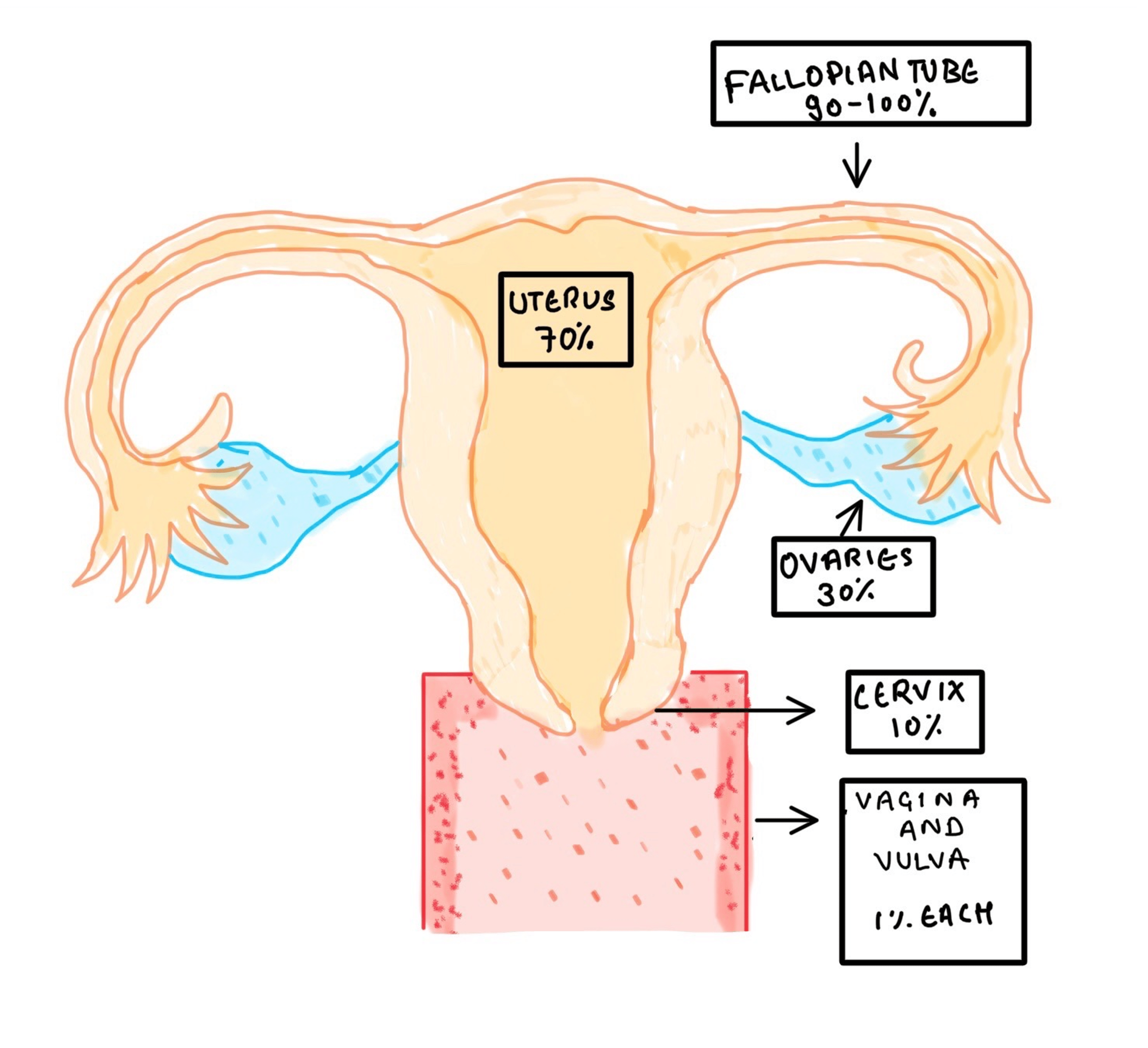 cureus-tuberculosis-in-the-female-genital-tract