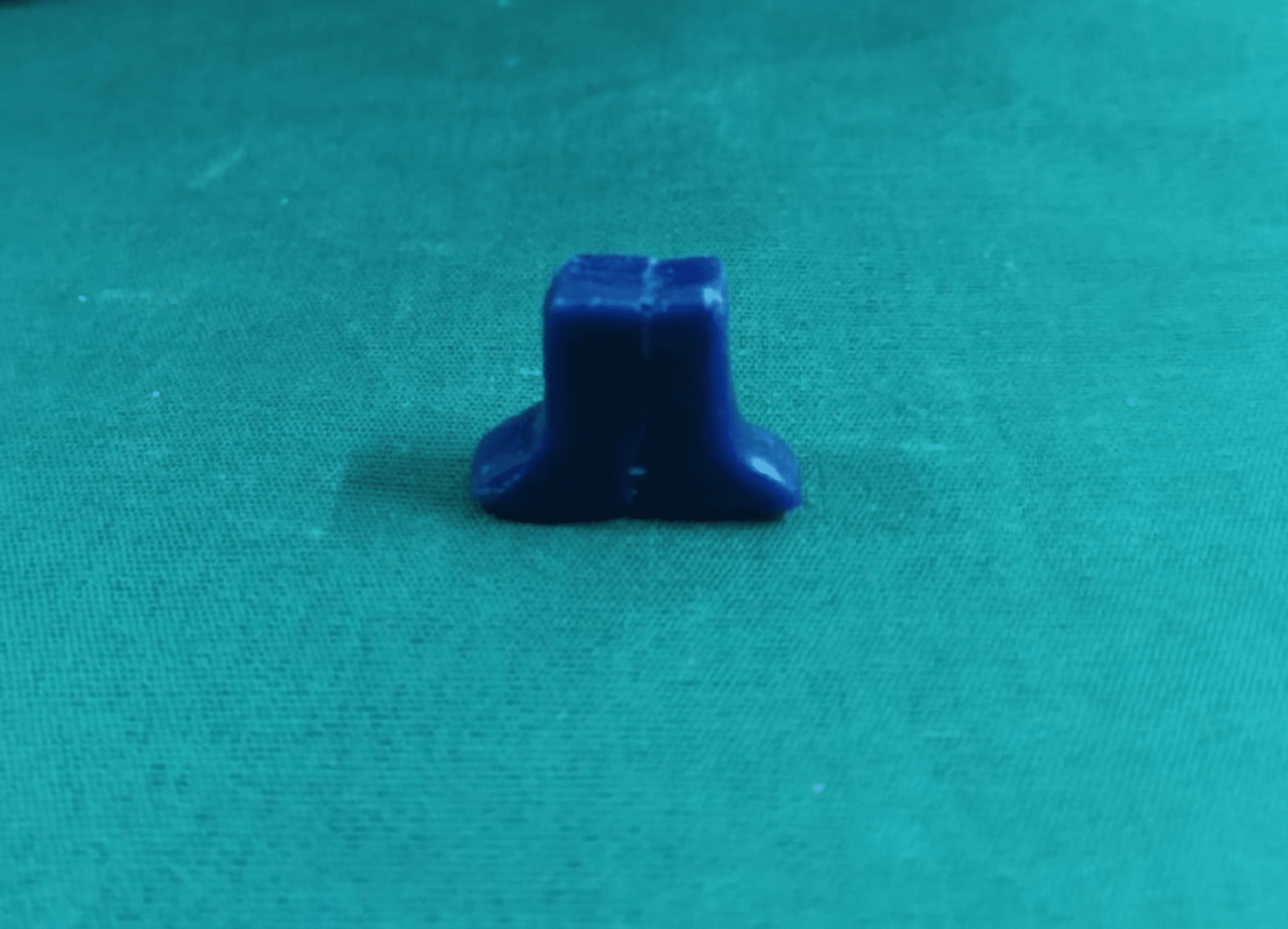 Cureus Custom Sectional Impression Tray With Sectional Handle for Microstomia Patients