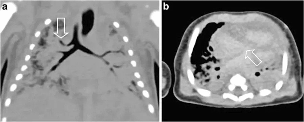 The Practicality Of Post-mortem Imaging In Prenatal, Perinatal, And ...