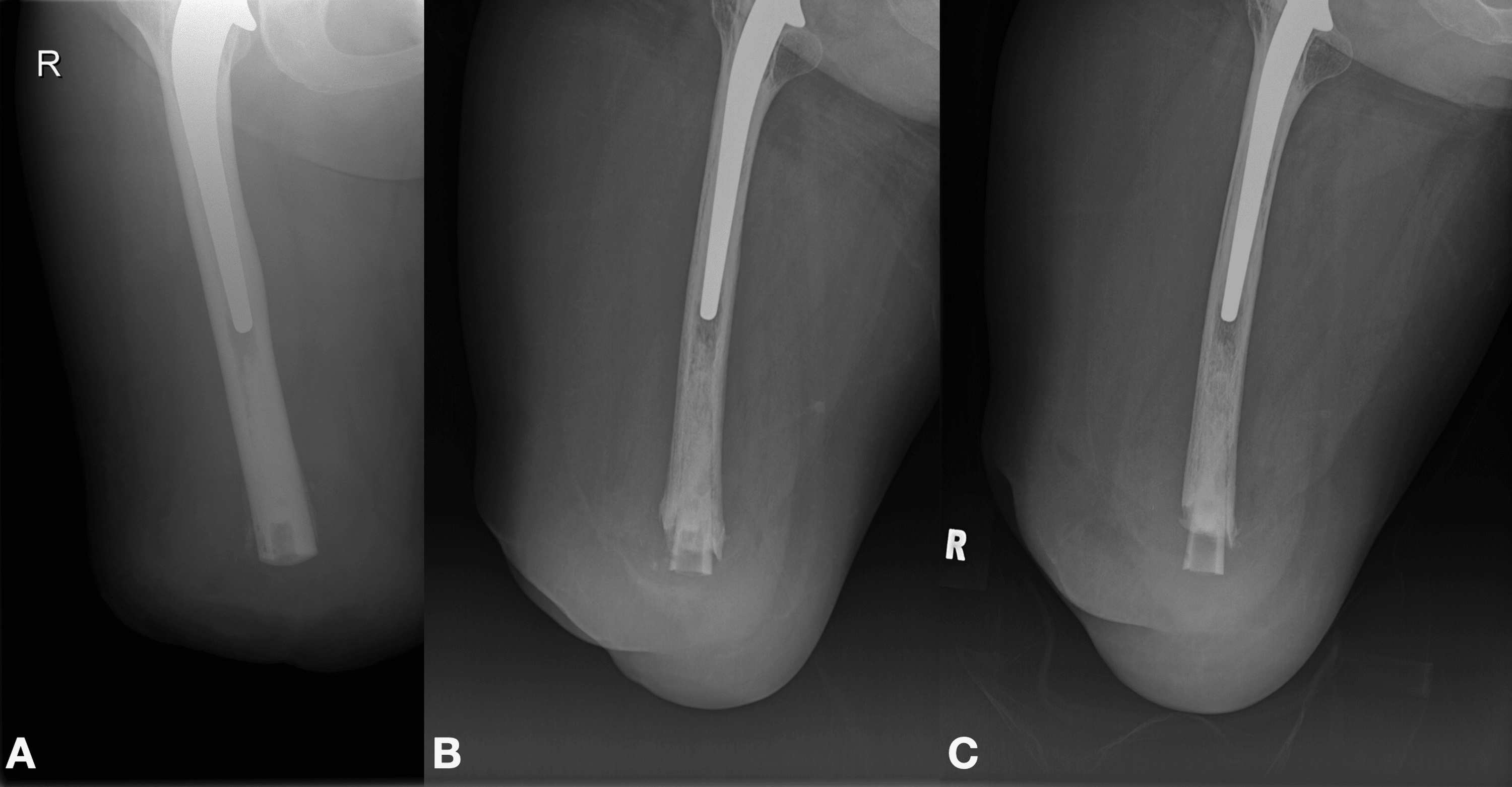 Cureus Stumped by the Mystery A Case Report of Progressive