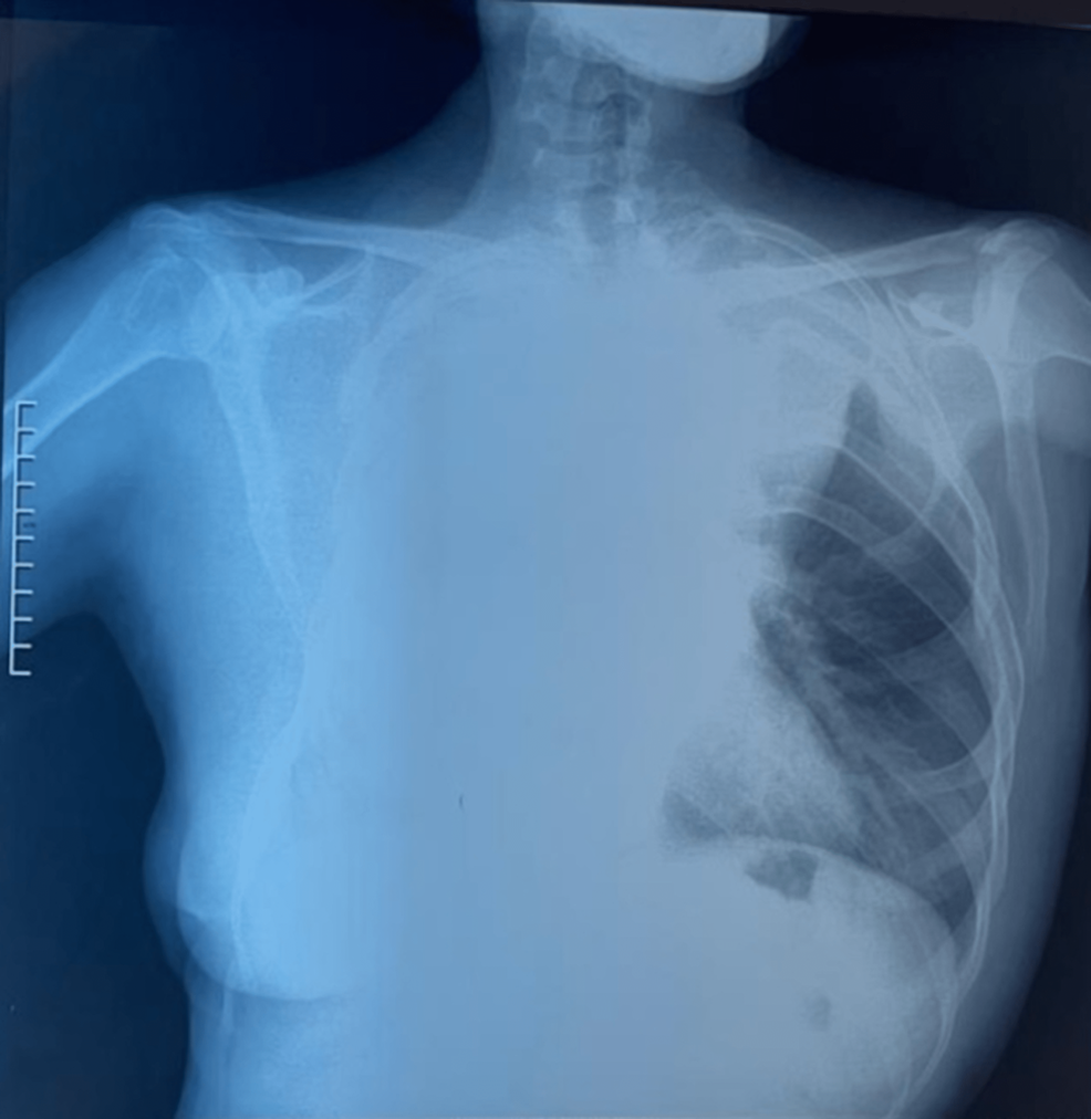 Chest-x-rays-of-the-patient.