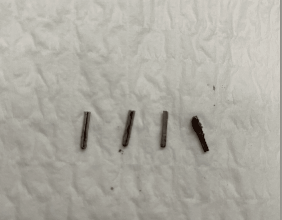 Four-stainless-steel-surgical-clips-were-removed-from-the-right-upper-quadrant.
