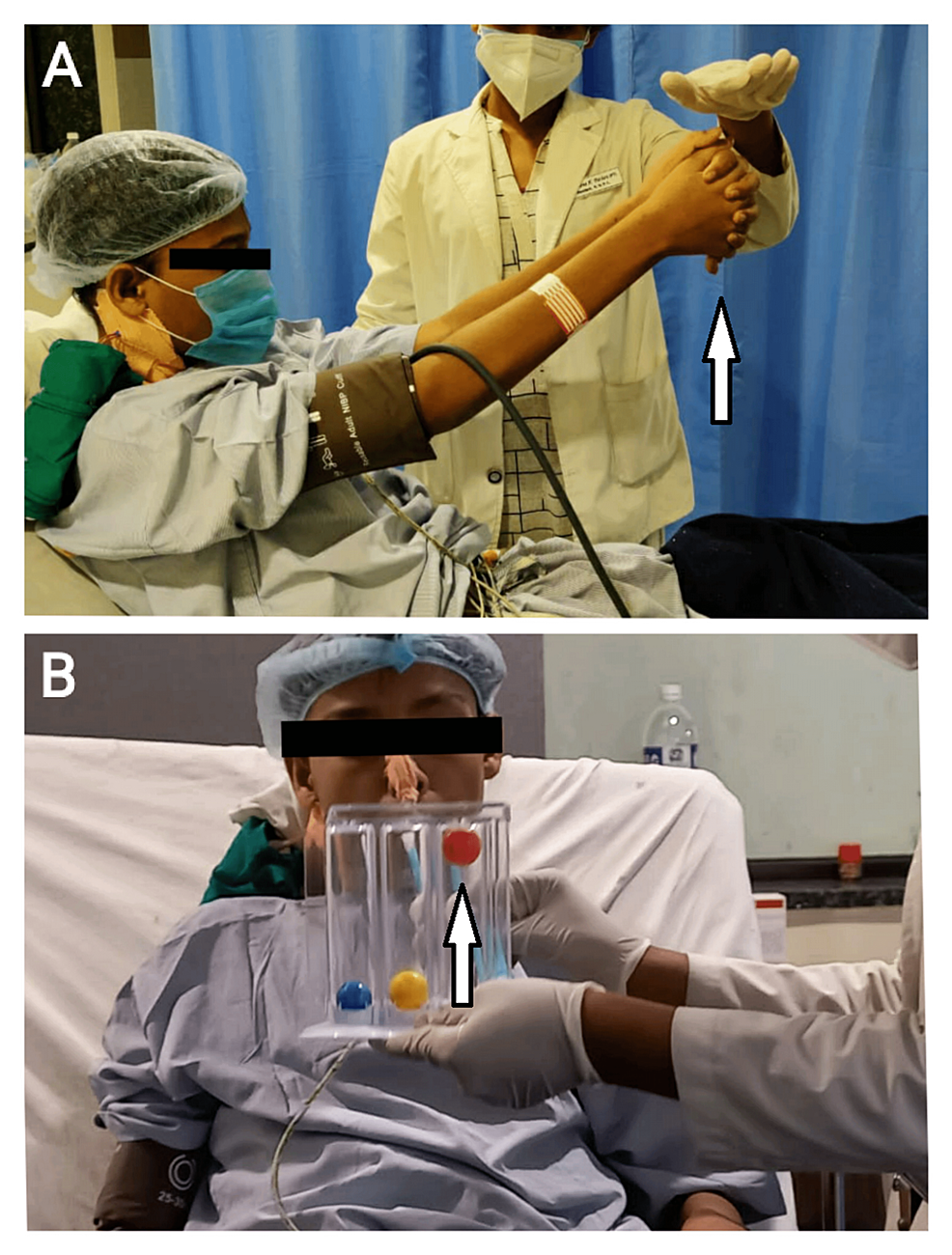 (A)-Postoperatively-in-surgery-ICU,-the-patient-is-performing-thoracic-expansion-exercise.-(B)-The-patient-using-an-incentive-spirometer