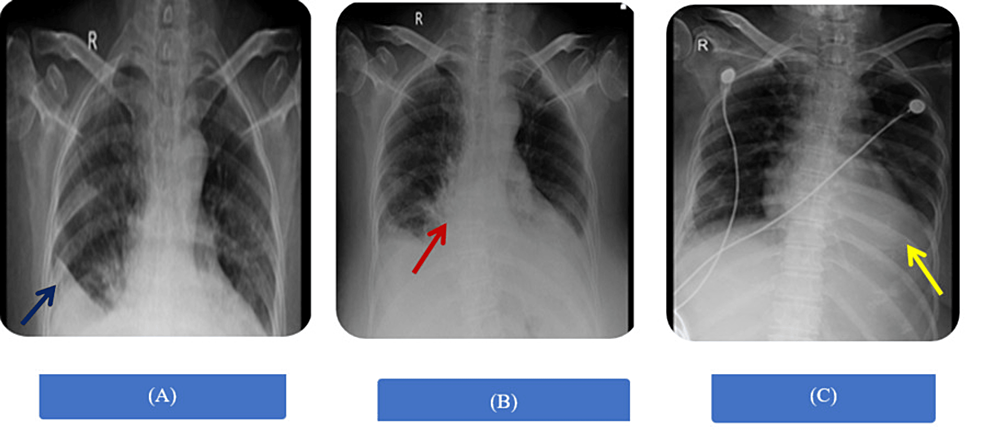 Breathing Labs – A Combat Journey With Pulmonary Rehabilitation And ...