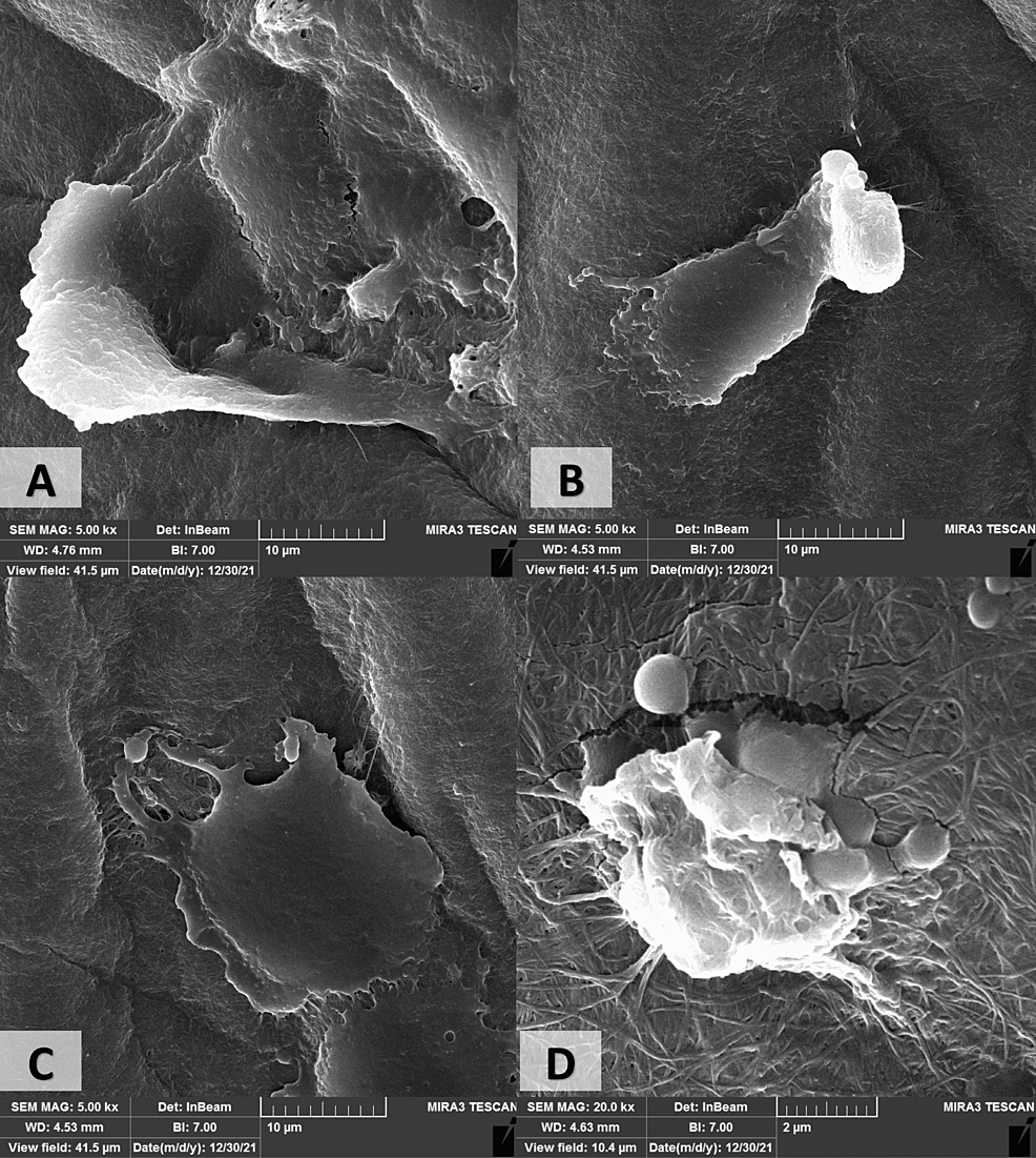 Field-emission-scanning-electron-microscope-images-for-the-cultured-human-adipose-tissue-derived-mesenchymal-stem-cells-on-the-chitosan/polyvinyl-alcohol-nanofibrous-scaffolds.