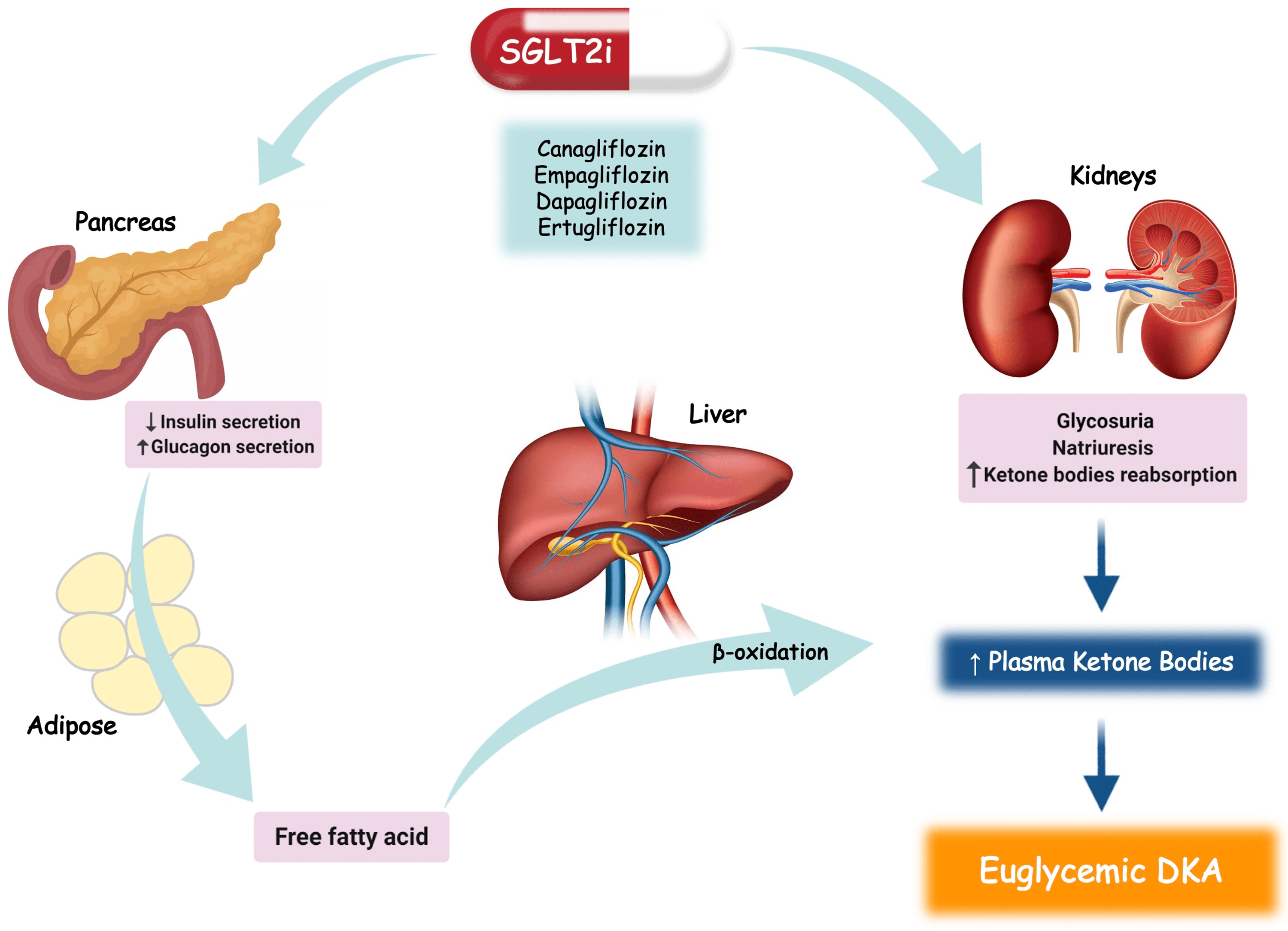 Cureus A Case of SGLT2 InhibitorInduced Euglycemic Diabetic Ketoacidosis