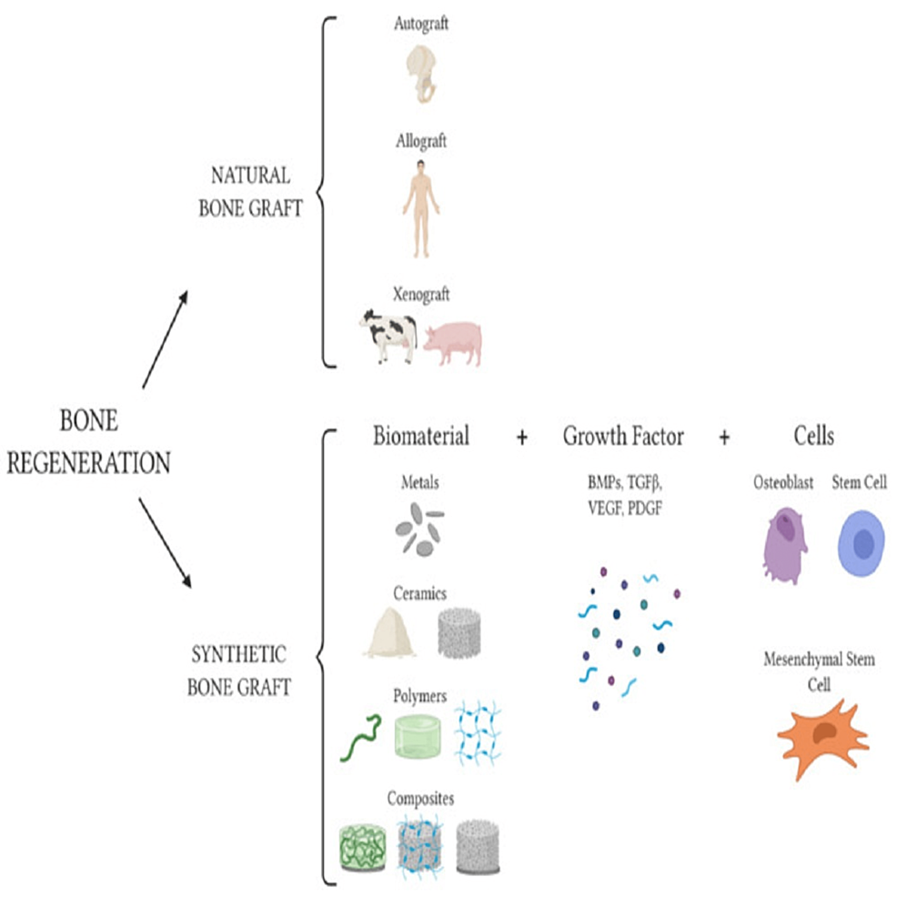 Schematic-of-available-options-for-bone-tissue-regeneration