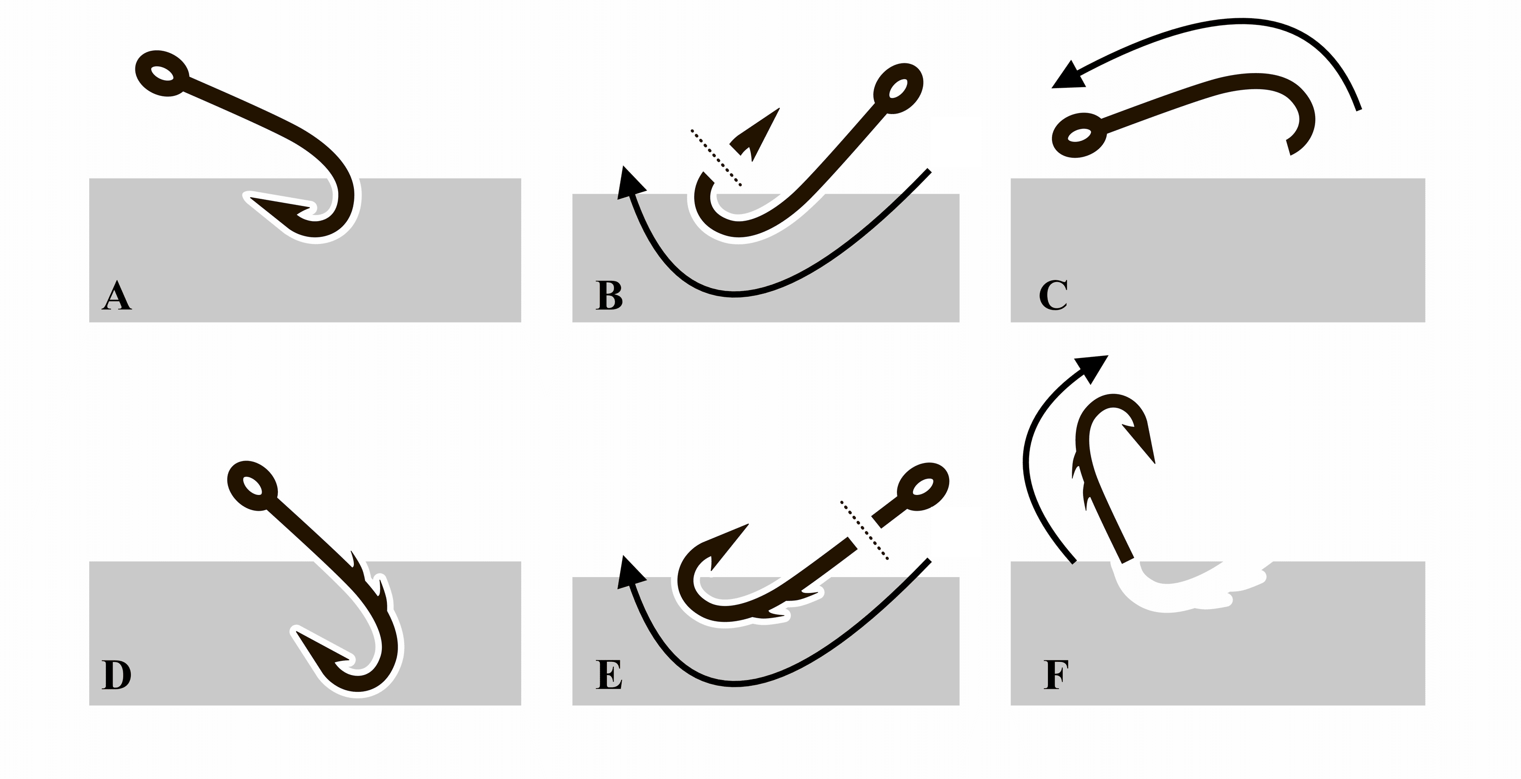 Cureus CUT BARB (an Acronym for Fishhook Injuries) Illustrated by
