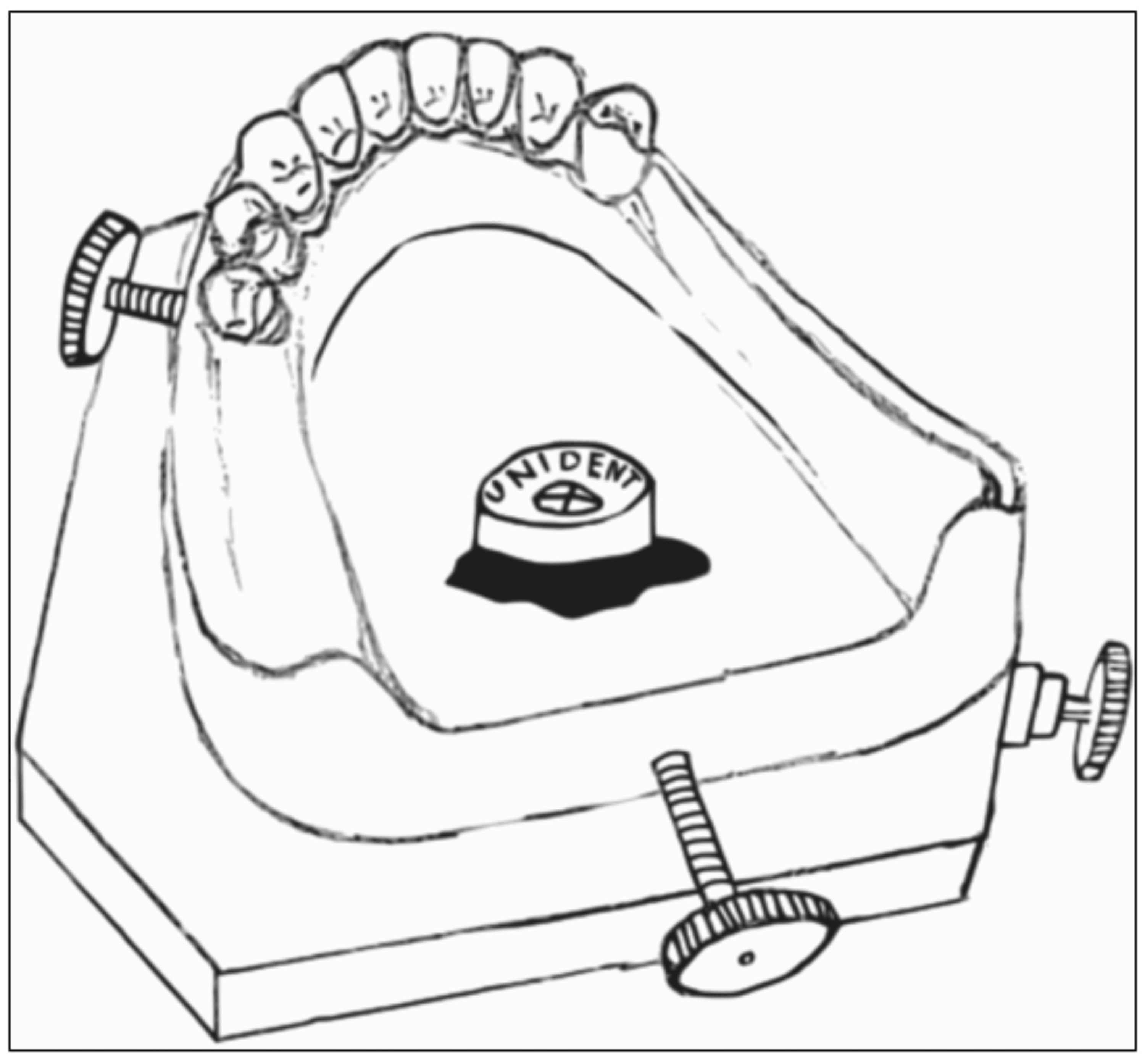 Cureus A Systematic Review of Tripoding A Step Towards Successful Rehabilitation