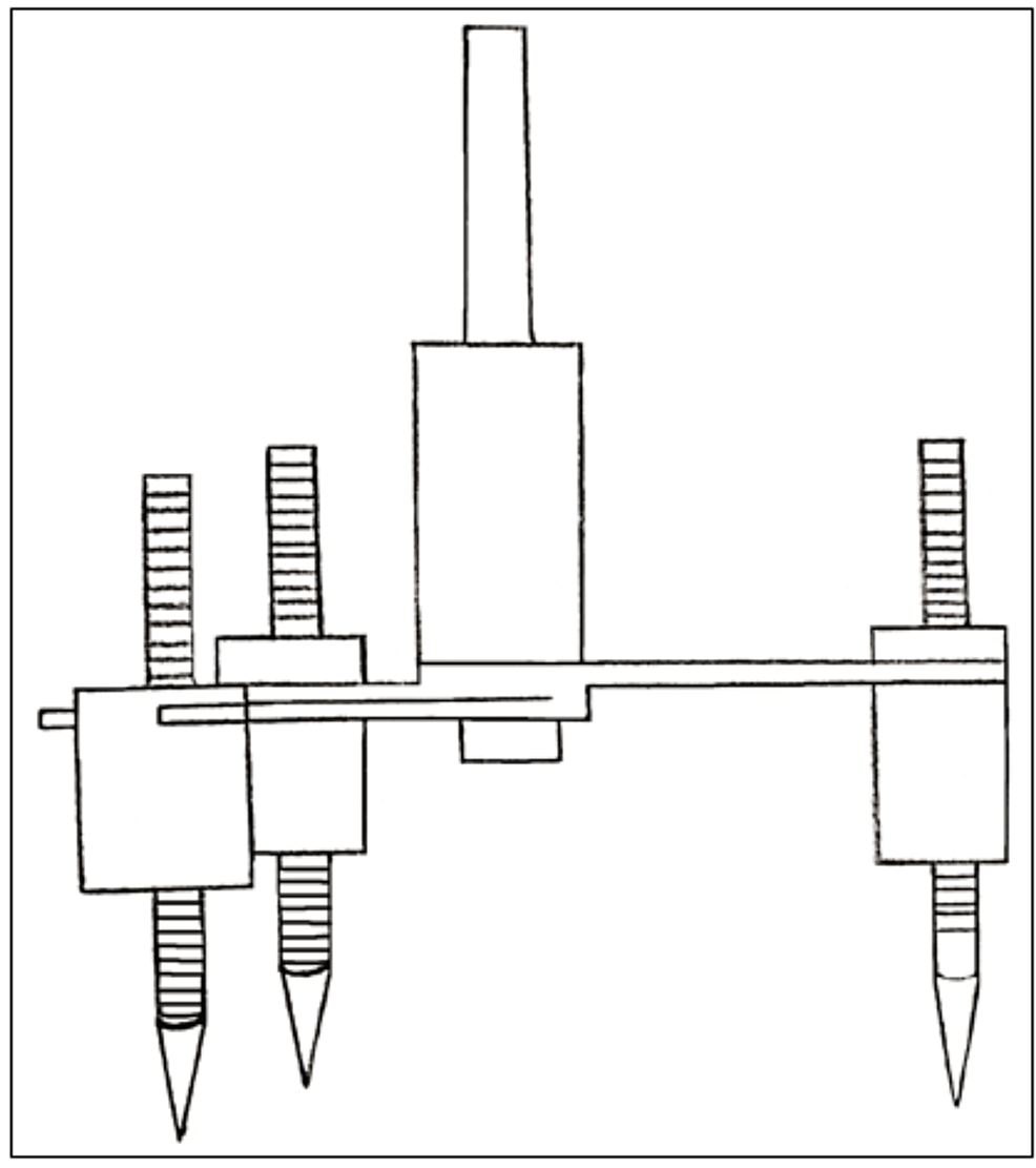Cureus A Systematic Review of Tripoding A Step Towards Successful