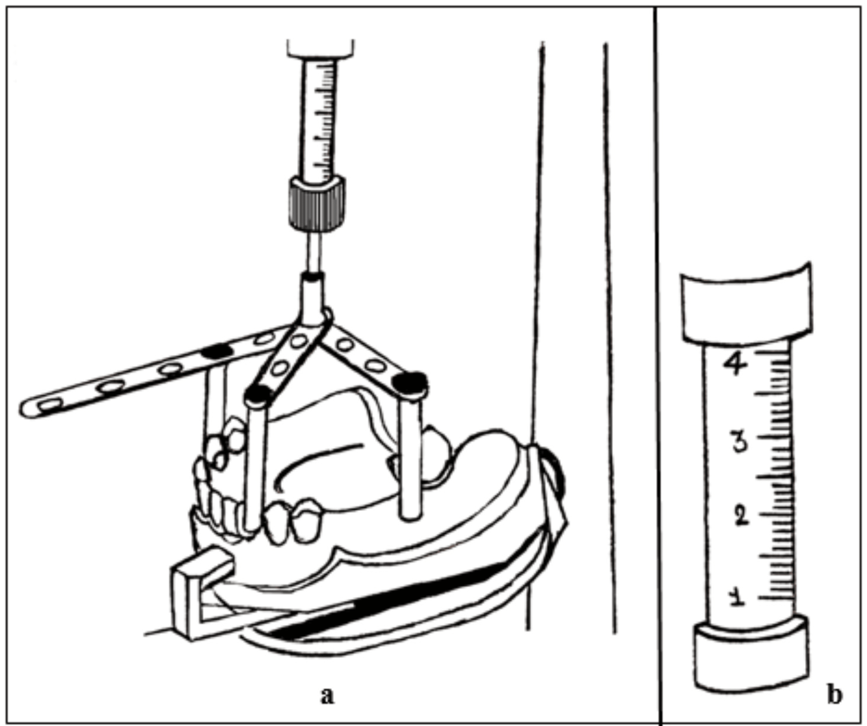 Cureus A Systematic Review of Tripoding A Step Towards Successful Rehabilitation