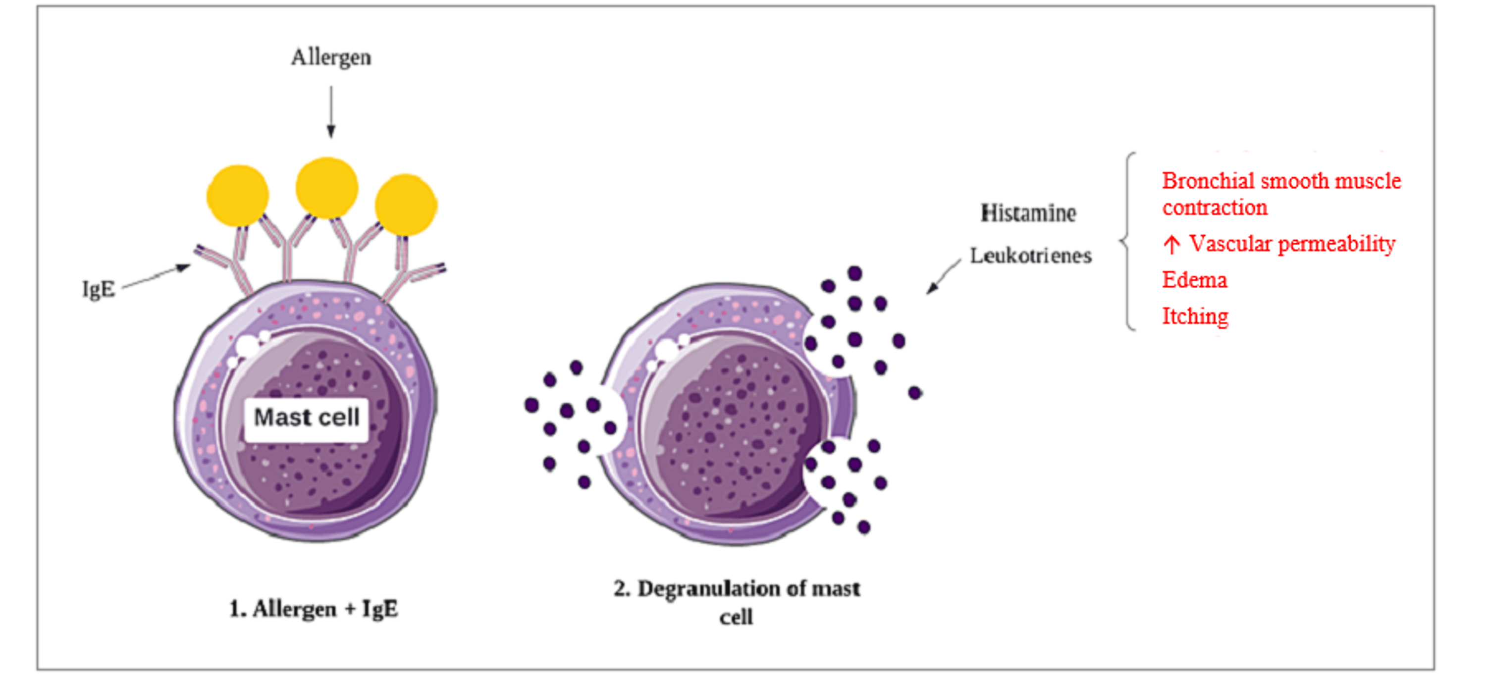 Cureus A Comprehensive Review of BradykininInduced Angioedema Versus