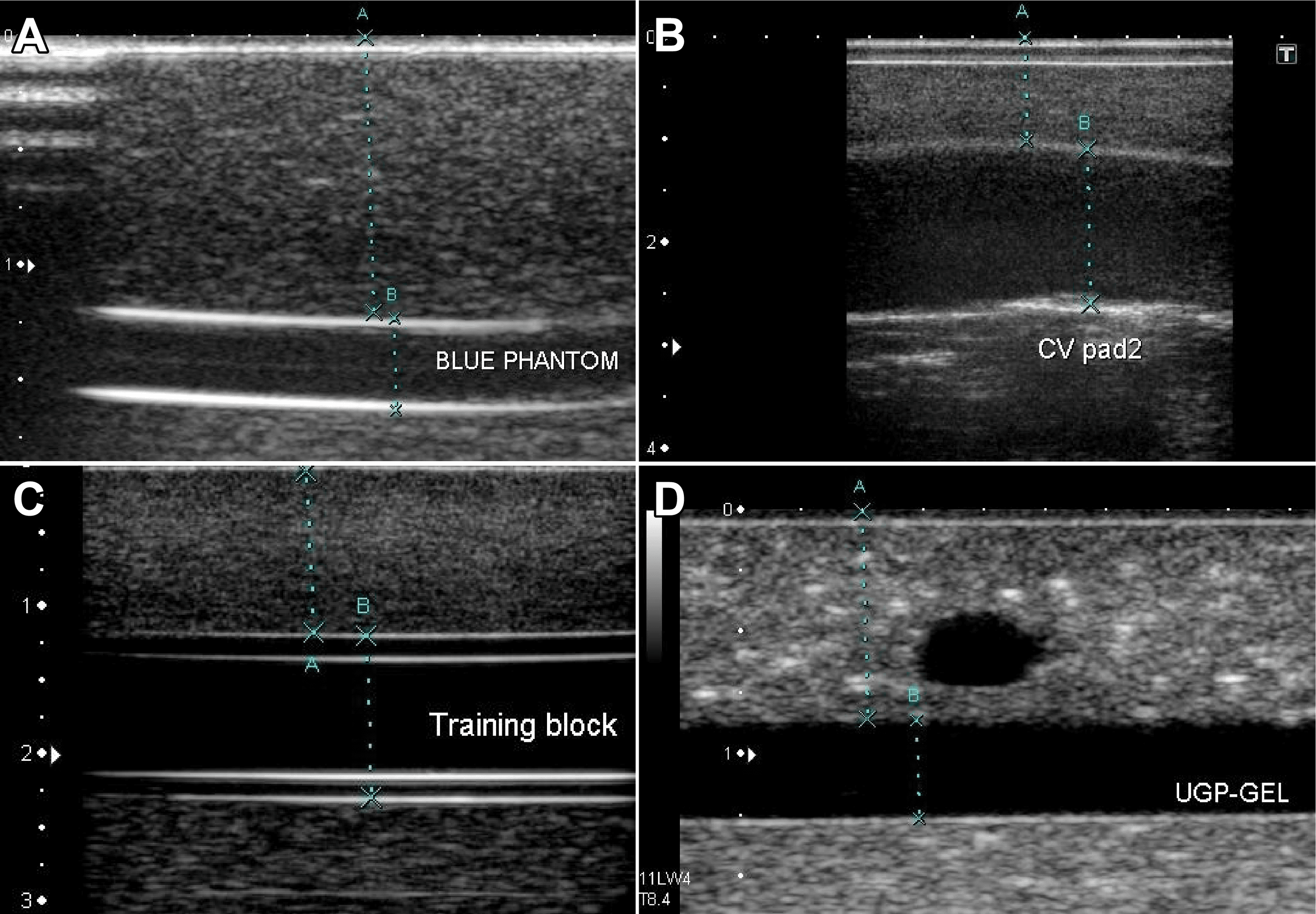 Cureus Measuring the Compression Force Required for Vascular