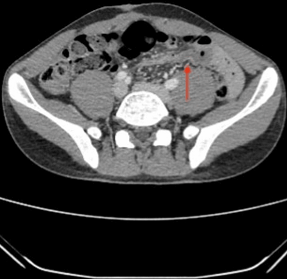 A Medical Conundrum in a Surgical Setting: Lessons Learned From an ...