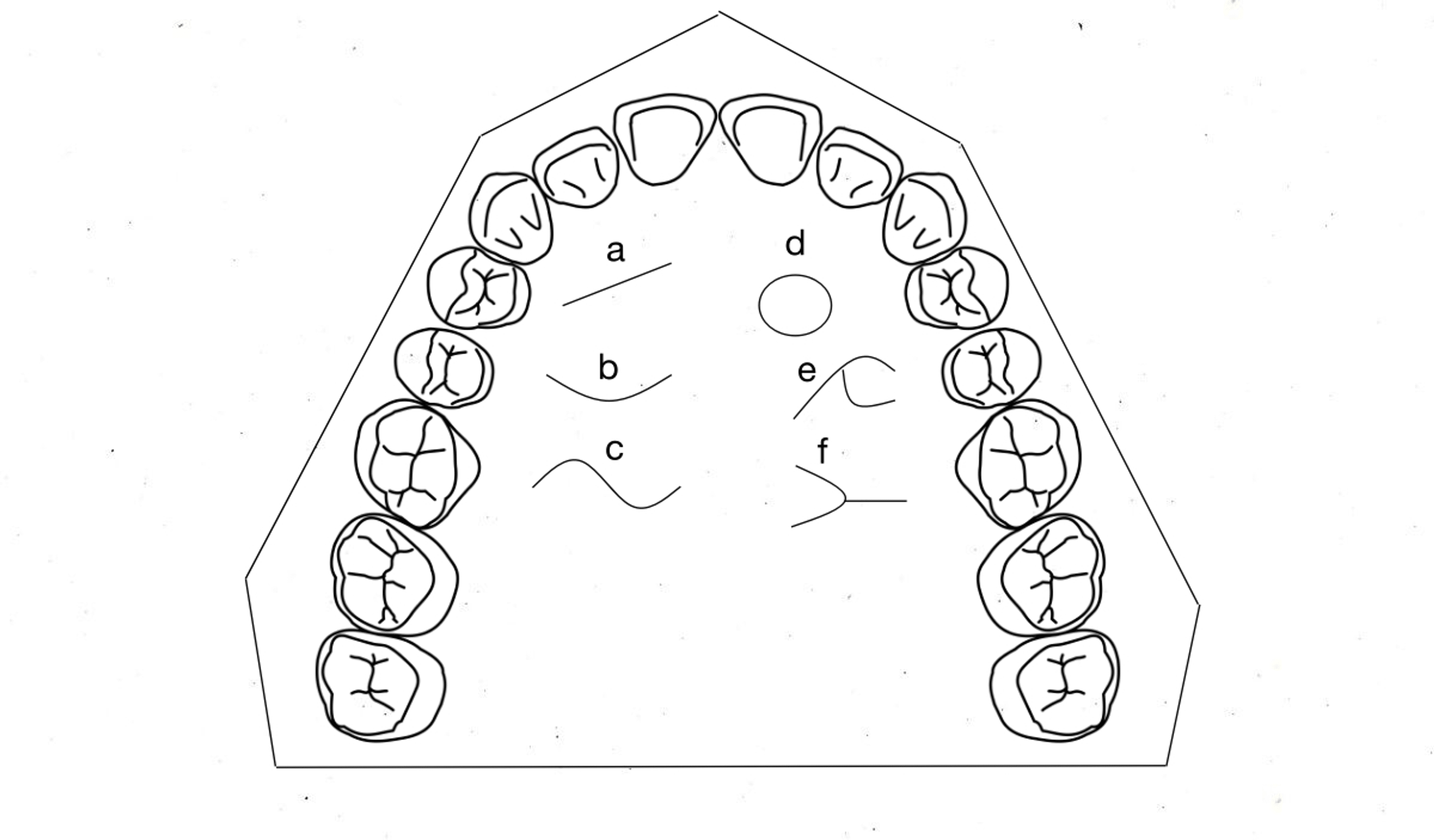 Cureus A Morphometric Analysis of Palatal Rugae Patterns in a Saudi