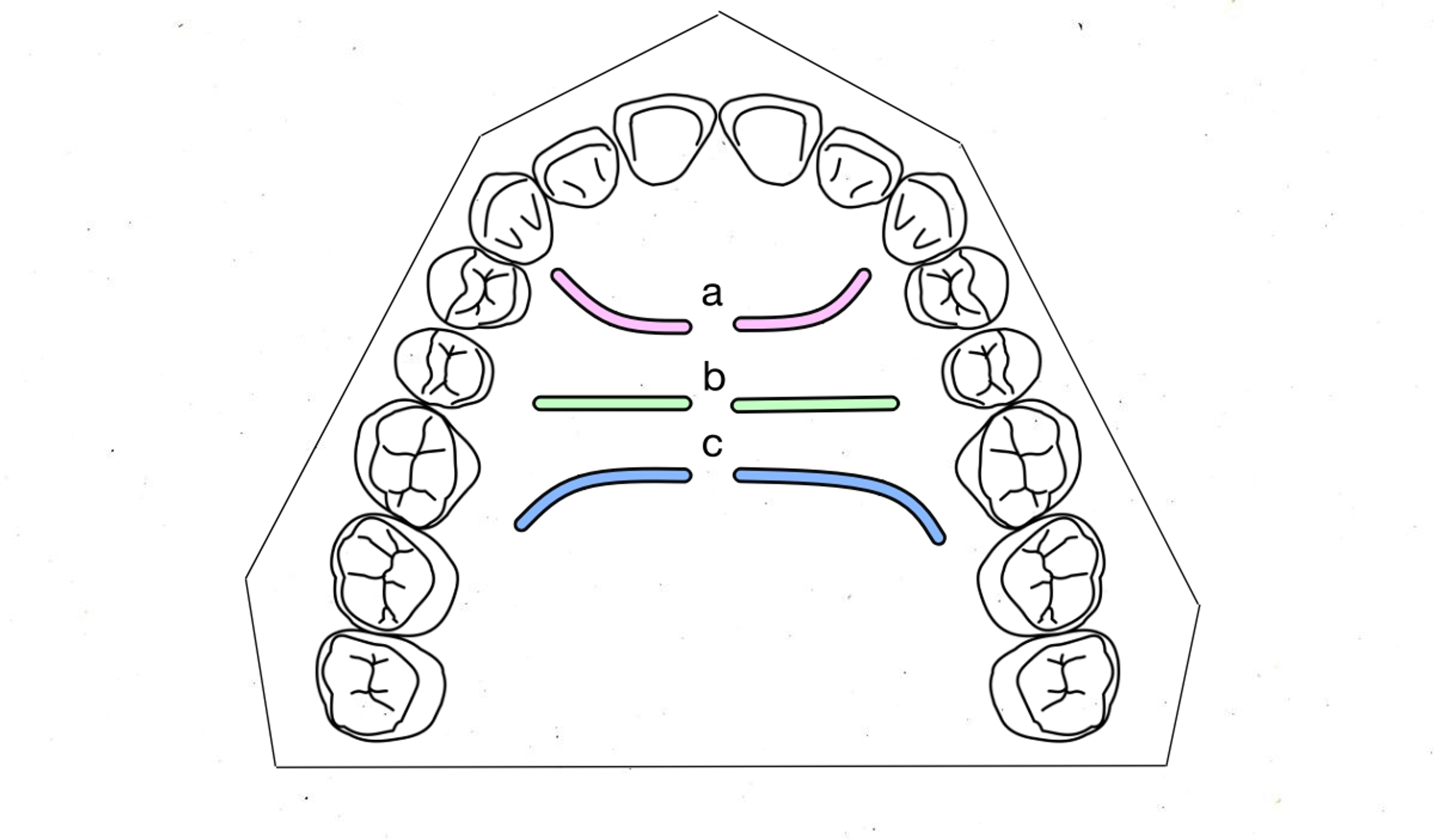 Cureus | A Morphometric Analysis of Palatal Rugae Patterns in a Saudi ...