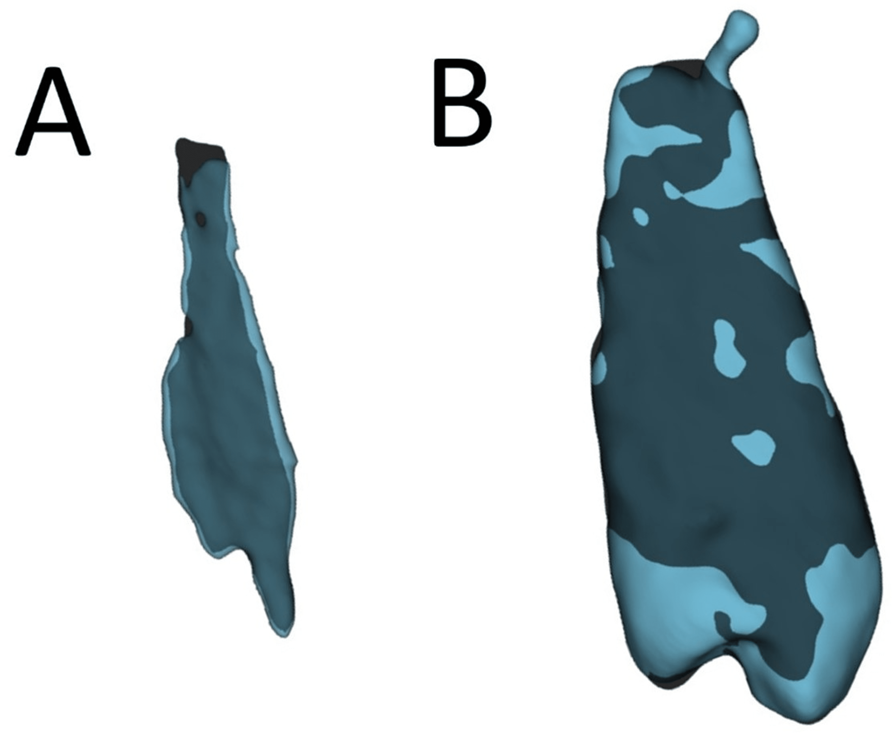 Automatic Pulp and Teeth ThreeDimensional Modeling of Single and Multi