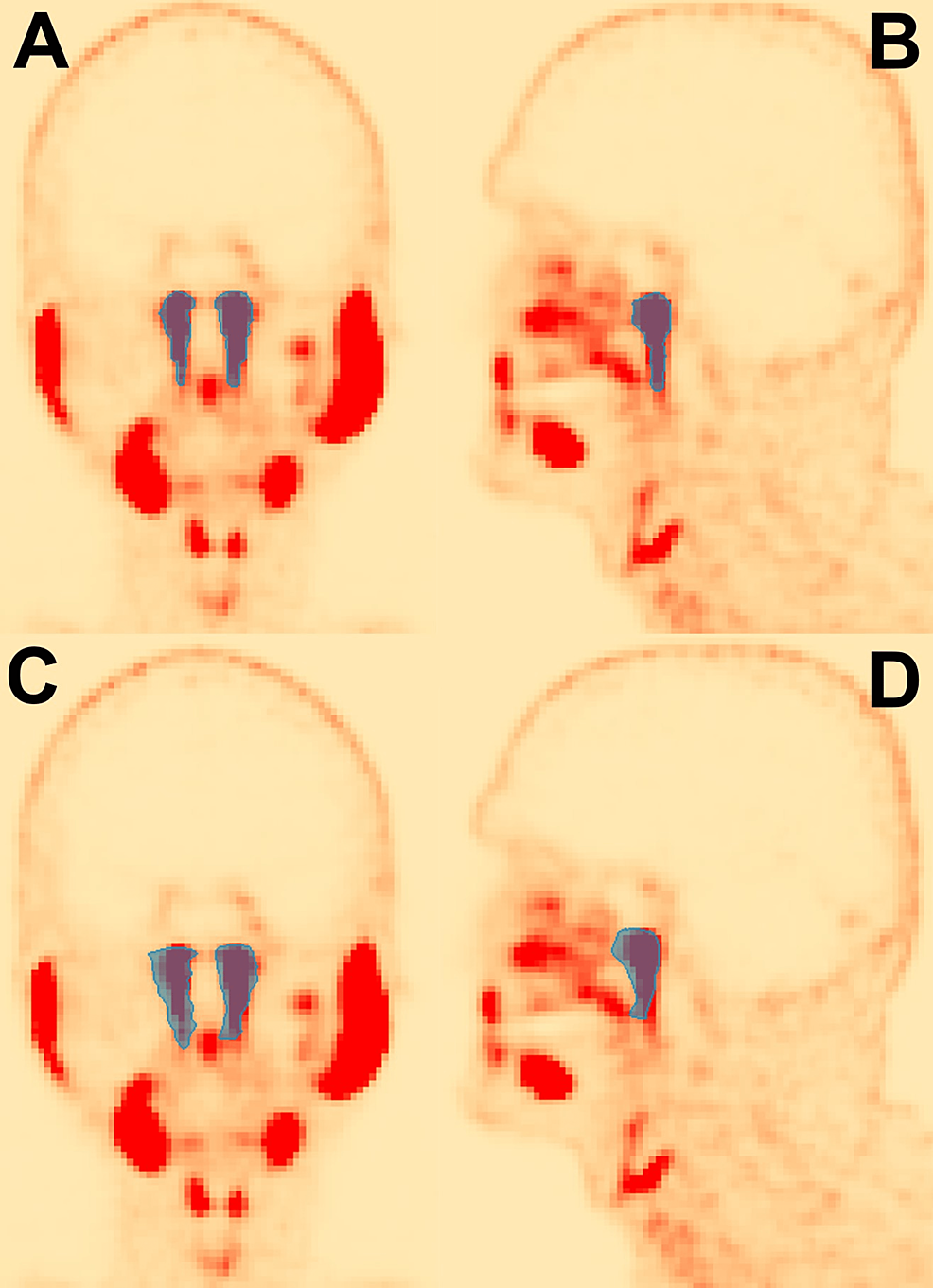 Cureus | Development of a CT-Based Auto-Segmentation Model for Prostate ...