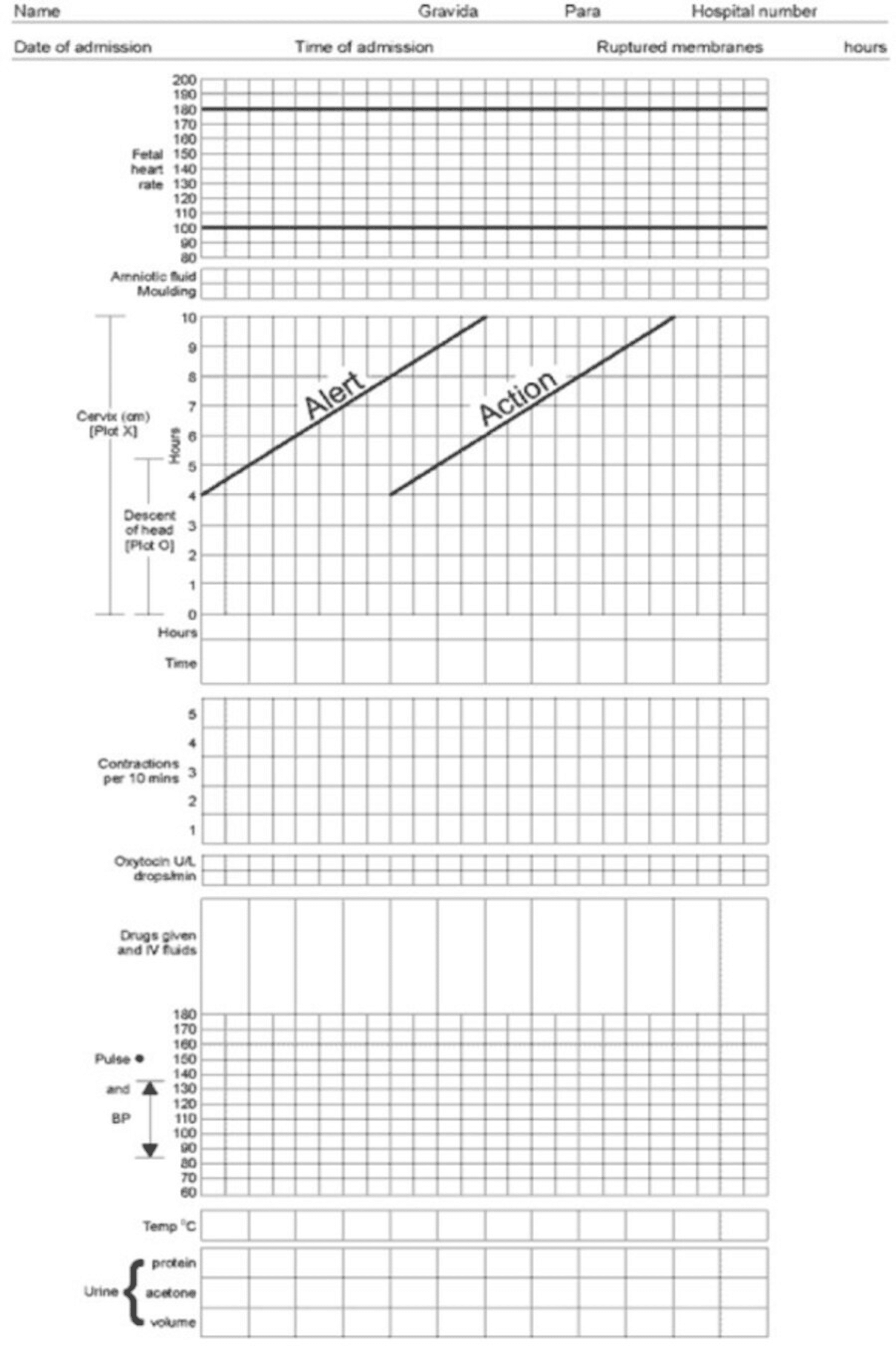 Cureus | Modified WHO Partograph in Labour Room: A Quality Improvement ...