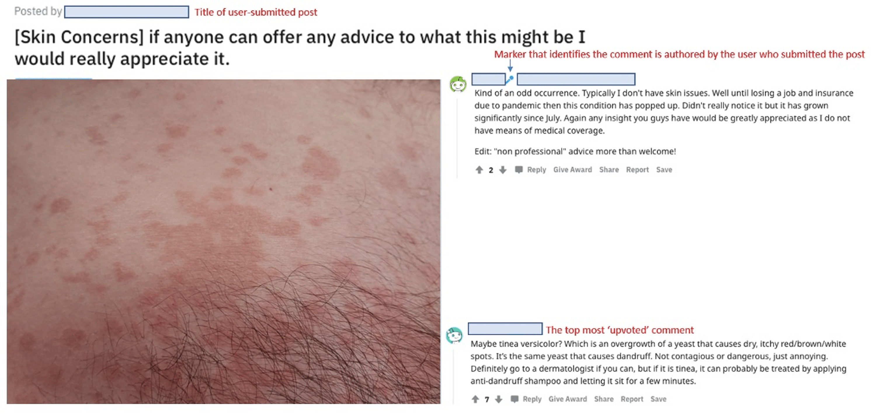 Social Media and Dermatology During the COVID19 Pandemic Analyzing