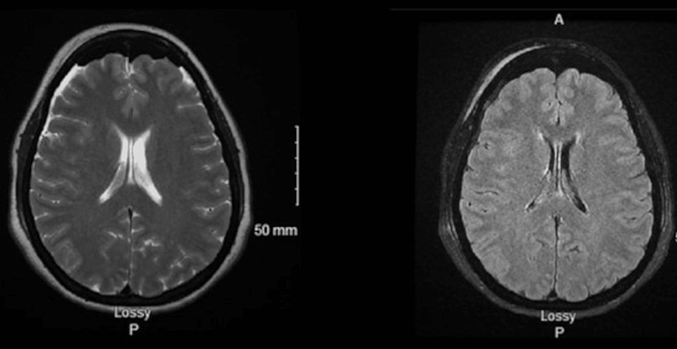 Axial magnetic resonance imaging of the brain.