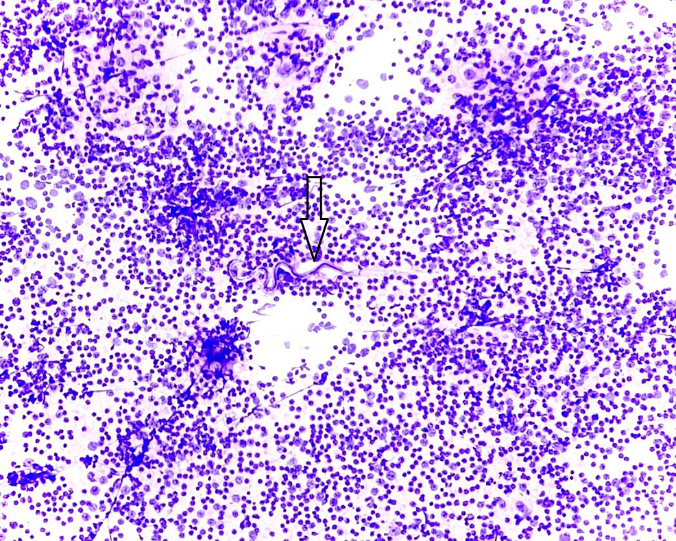 Hematoxylin-and-eosin-staining;-10x-power-showing-cell-smear-with-mixed-cell-population.