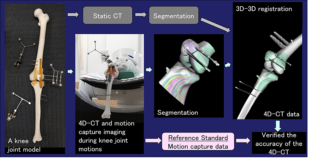 Cureus Accuracy Verification of Four Dimensional CT Analysis of