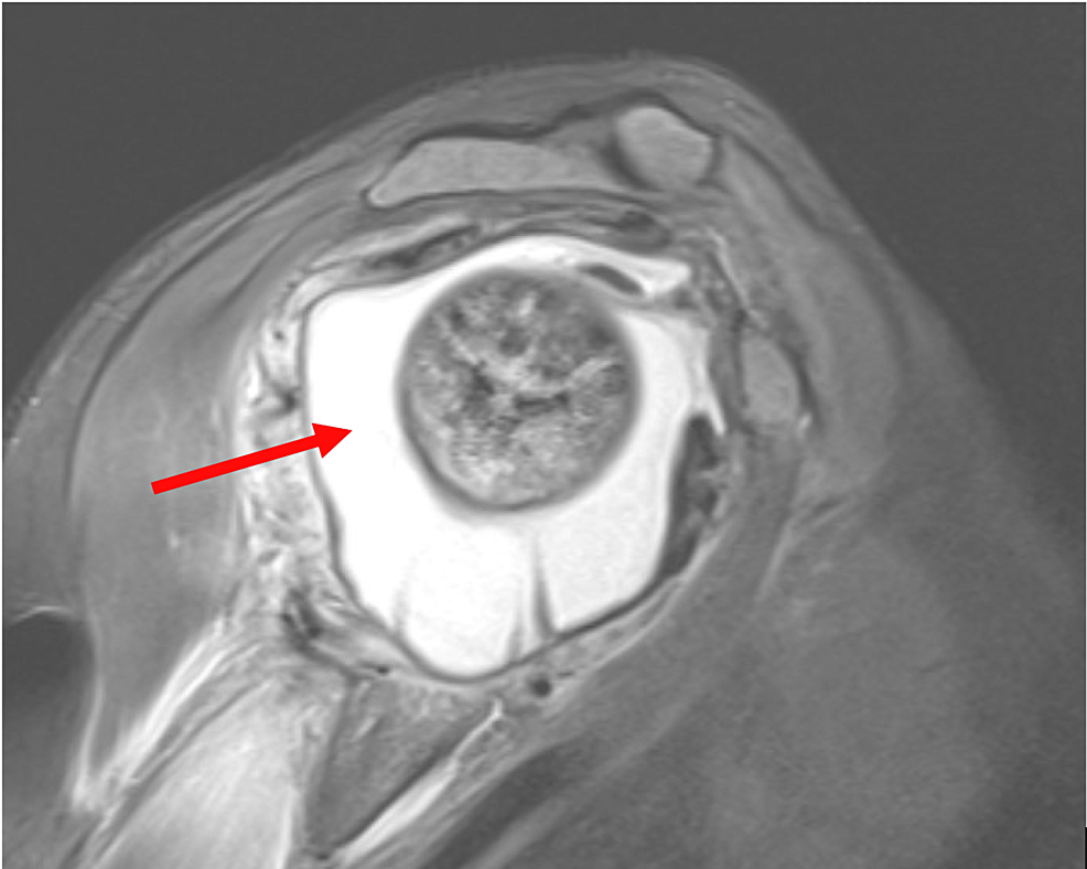 関節痛と関節炎: それらは同じですか?