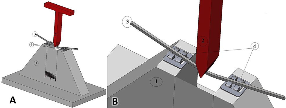 Superelastic NiTi 0.014-inch during initial alignment orthodontic