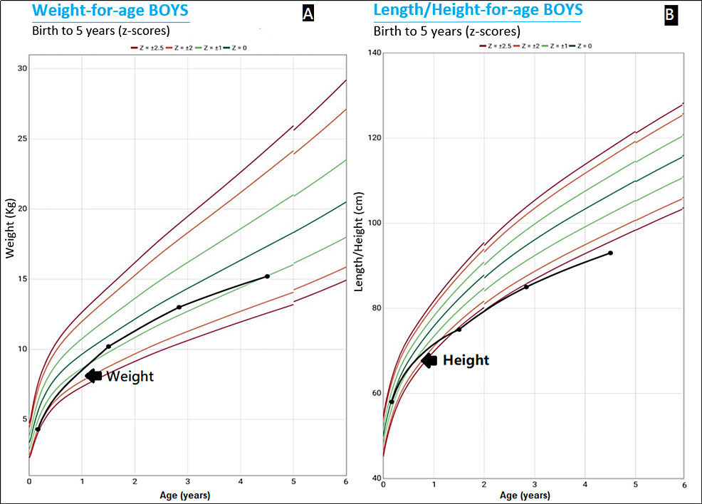 What You See and What You Don't: Diagnosing Niemann Pick, Type C - Complex  Child