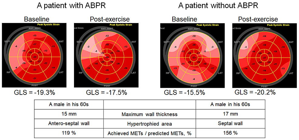 Cureus  Left Ventricular Global Longitudinal Strain in Patients