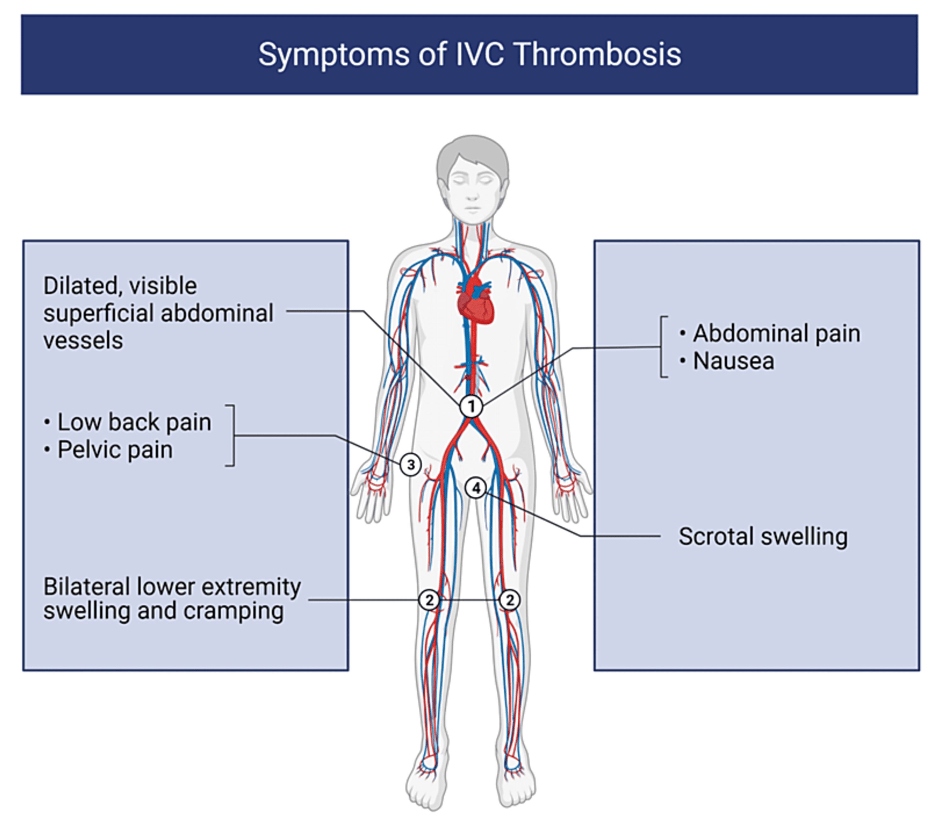 Icd 10 For Bilateral Lower Extremity Edema 46 - ndx2qzz