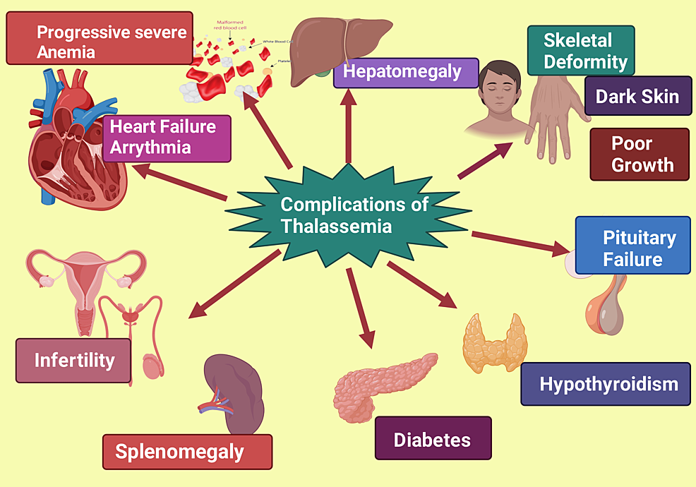 Thalassemia Reports, Free Full-Text