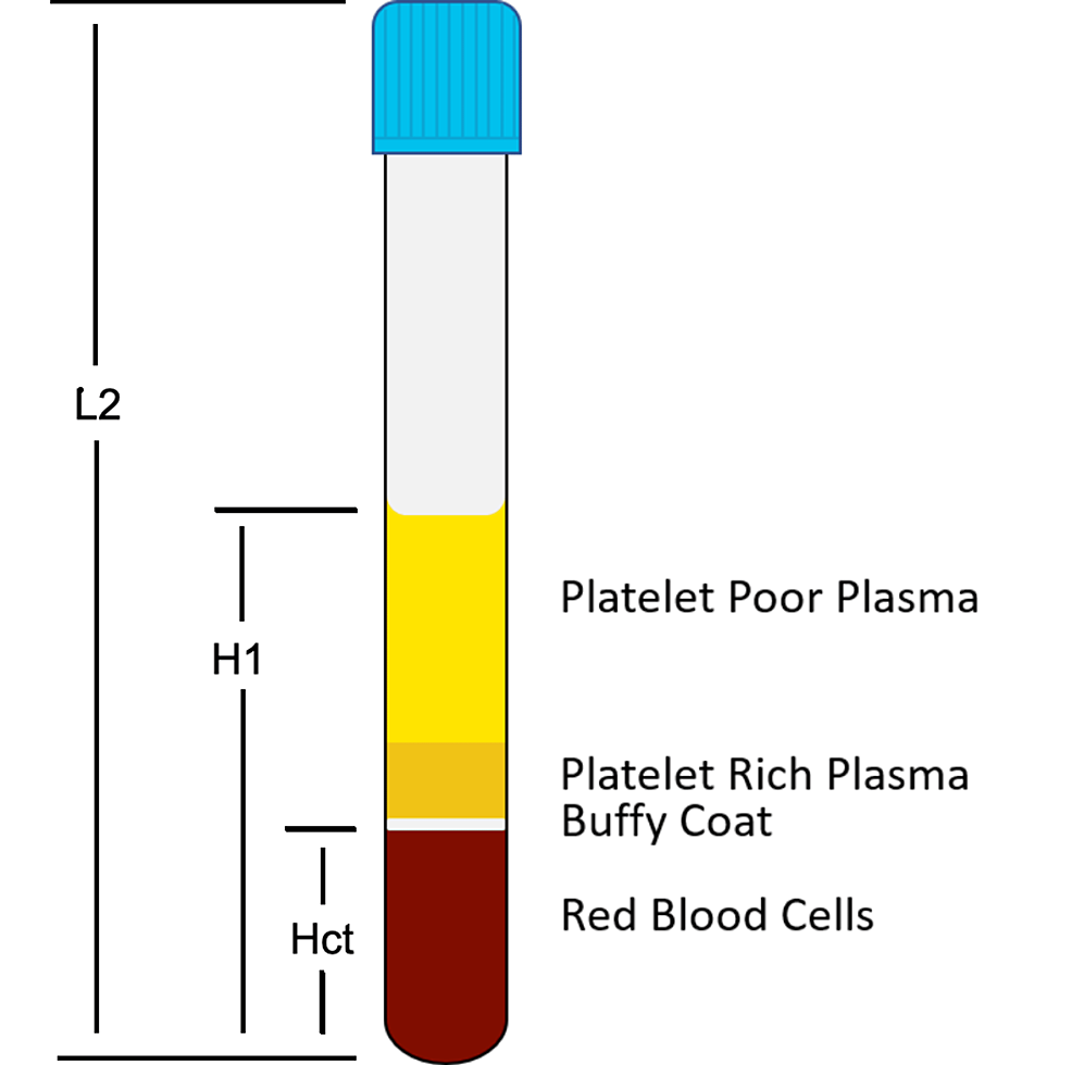 The Many Uses of Plasma — Stanford Blood Center